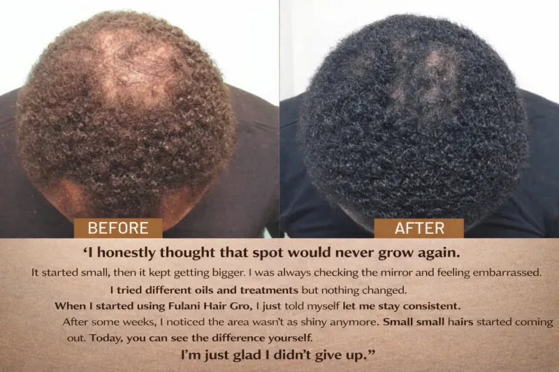 Before and After Results 7